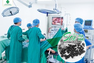 Phẫu thuật nội soi cắt túi mật chứa hàng chục viên sỏi