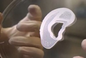 Mỹ lần đầu tiên cấy ghép thành công tai người in 3D