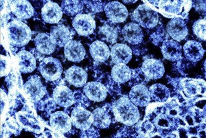 Mở rộng giải trình tự gene đối với virus gây các bệnh hô hấp ngoài COVID-19